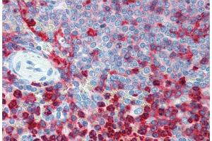 Immunohistochemistry staining of human spleen (paraffin sections) using anti-CD18 (MEM-48).