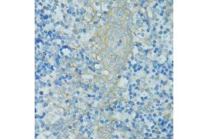 Immunohistochemistry of paraffin-embedded human tonsil using TJP2 antibody.