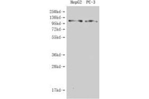 Western Blot Positive WB detected in: HepG2 whole cell lysate, Hela whole cell lysate All lanes: GPRC6A antibody at 4. (GPRC6A anticorps  (AA 403-581))