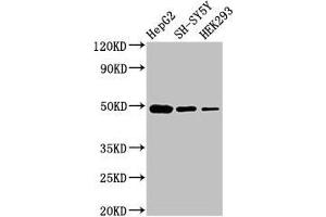 Western Blot Positive WB detected in: HepG2 whole cell lysate, SH-SY5Y whole cell lysate, HEK293 whole cell lysate All lanes: FDFT1 antibody at 3 μg/mL Secondary Goat polyclonal to rabbit IgG at 1/50000 dilution Predicted band size: 49, 41, 39, 36, 44 kDa Observed band size: 49 kDa