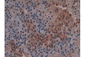 Detection of GSTt2 in Rat Adrenal gland Tissue using Polyclonal Antibody to Glutathione S Transferase Theta 2 (GSTt2)