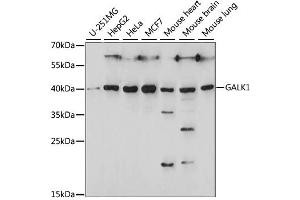 Western blot analysis of extracts of various cell lines, using GALK1 antibody. (GALK1 anticorps)