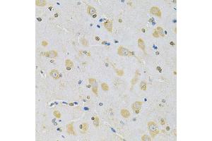 Immunohistochemistry of paraffin-embedded rat brain using CAMK1D Antibody (ABIN5975586) at dilution of 1/100 (40x lens). (CAMK1D anticorps)