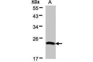 WB Image Sample(30 μg of whole cell lysate) A:H1299 12% SDS PAGE antibody diluted at 1:500 (BTF3 anticorps)