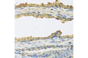 Immunohistochemistry of paraffin-embedded human prostate using TSHB antibody (ABIN6132751, ABIN6149620, ABIN6149621 and ABIN6222522) at dilution of 1:100 (40x lens).