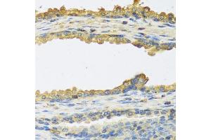 Immunohistochemistry of paraffin-embedded human prostate using TSHB antibody (ABIN6132751, ABIN6149620, ABIN6149621 and ABIN6222522) at dilution of 1:100 (40x lens). (TSHB anticorps  (AA 21-138))