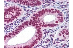 Immunohistochemistry (IHC) image for anti-Runt-Related Transcription Factor 2 (RUNX2) (AA 251-351) antibody (ABIN614586)