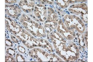 Image no. 4 for anti-Acetyl-CoA Acetyltransferase 2 (ACAT2) antibody (ABIN1496401) (ACAT2 anticorps)