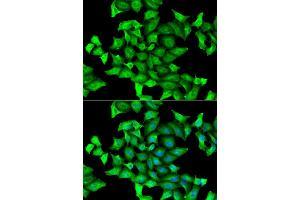 Immunofluorescence analysis of HeLa cell using SEPSECS antibody. (SEPSECS anticorps)