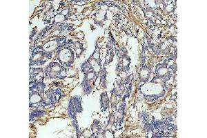 IHC analysis of ICAM1 using anti-ICAM1 antibody (ABIN5692991). (ICAM1 anticorps  (AA 28-268))