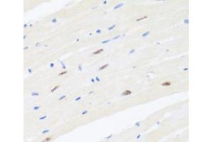 Immunohistochemistry of paraffin-embedded Mouse heart using BRMS1 Polyclonal Antibody at dilution of 1:100 (40x lens). (BRMS1 anticorps)