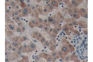 Detection of NEIL1 in Human Liver Tissue using Polyclonal Antibody to Nei Endonuclease VIII Like Protein 1 (NEIL1)