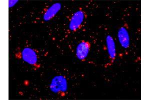 Proximity Ligation Analysis of protein-protein interactions between MAPK13 and MAPKAPK3.
