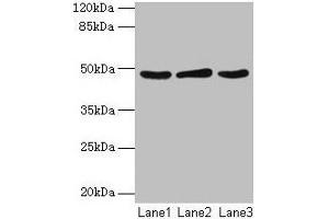 Western blot All lanes: Serpinb2 antibody at 2 μg/mL Lane 1: MCF-7 whole cell lysate Lane 2: 293T whole cell lysate Lane 3: Rat liver tissue Secondary Goat polyclonal to rabbit IgG at 1/10000 dilution Predicted band size: 48 kDa Observed band size: 48 kDa (SERPINB2 anticorps  (AA 1-416))