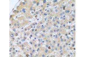 Immunohistochemistry of paraffin-embedded Human liver using APOA5 Polyclonal Antibody at dilution of 1:100 (40x lens). (APOA5 anticorps)