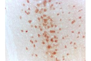 Frozen mouse brain sections labeled with Anti-WNT5A Polyclonal Antibody, Unconjugated (ABIN675758) at 1:1000 followed by conjugation to the secondary antibody