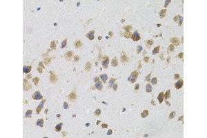 Immunohistochemistry of paraffin-embedded Mouse brain using FLT3 Polyclonal Antibody