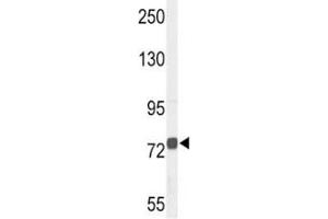 Western blot analysis of CHAT antibody and NCI-H460 lysate.