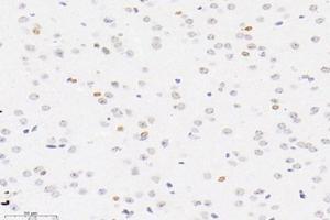 Immunohistochemistry analysis of paraffin-embedded mouse brain using,PLK5 (ABIN7075111) at dilution of 1: 4000 (PLK5 anticorps)