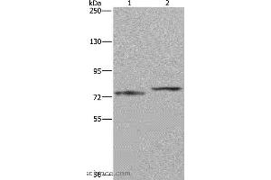 Western blot analysis of Mouse heart tissue and 231 cell, using AATF Polyclonal Antibody at dilution of 1:667