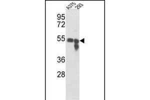 Western blot analysis of Tyrosinase Antibody (Center) (ABIN391521 and ABIN2841481) in , 293 cell line lysates (35 μg/lane). (TYR anticorps  (AA 176-205))