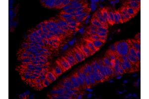 Immunofluorescence (IF) image for anti-rho Guanine Nucleotide Exchange Factor (GEF) 5 (ARHGEF5) (AA 600-650) antibody (ABIN7448930) (ARHGEF5 anticorps  (AA 600-650))
