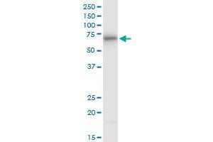 ATE1 monoclonal antibody (M01), clone 2B6.