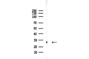 anti-Cytochrome B5 Reductase 1 (CYB5R1) (C-Term) antibody