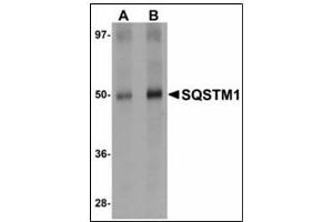 Western blot analysis of SQSTM1 in Human spleen tissue lysate with SQSTM1 antibody at (A) 1 and (B) 2 µg/ml. (SQSTM1 anticorps  (C-Term))