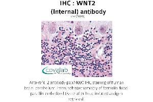 Image no. 1 for anti-Wingless-Type MMTV Integration Site Family Member 2 (WNT2) (Internal Region) antibody (ABIN1740825) (WNT2 anticorps  (Internal Region))