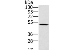 Western Blot analysis of 231 cell using PSMC2 Polyclonal Antibody at dilution of 1:500