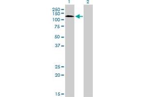 Western Blot analysis of RNF111 expression in transfected 293T cell line by RNF111 monoclonal antibody (M05), clone 1C4. (RNF111 anticorps  (AA 1-108))