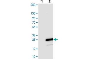 Western blot analysis of Lane 1: Negative control (vector only transfected HEK293T lysate). (TOMM20L anticorps)