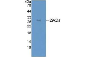 Figure. (RND1 anticorps  (AA 1-229))