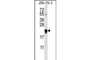 GAGE12H Antibody (N-term) (ABIN657560 and ABIN2846567) western blot analysis in ZR-75-1 cell line lysates (35 μg/lane). (G Antigen 12H anticorps  (N-Term))