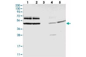 Western blot analysis of Lane 1: RT-4, Lane 2: U-251 MG, Lane 3: Human Plasma, Lane 4: Liver, Lane 5: Tonsil with G3BP2 polyclonal antibody  at 1:250-1:500 dilution.