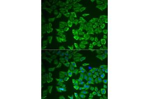 anti-Corticotropin Releasing Hormone Binding Protein (CRHBP) (AA 25-322) antibody