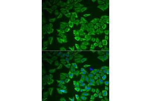 Immunofluorescence analysis of HeLa cells using CRHBP antibody (ABIN6129571, ABIN6139030, ABIN6139033 and ABIN6222243). (CRHBP anticorps  (AA 25-322))
