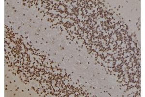 ABIN6277453 at 1/100 staining Rat brain tissue by IHC-P. (PARP1 anticorps  (Internal Region))