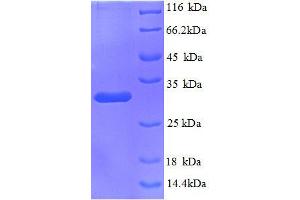 Kininogen 1 (KNG1) (AA 390-644) protein (His tag)