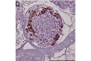 Immunohistochemical staining of tumor biopsy and biopsy spheroid sections. (KRT20 anticorps)
