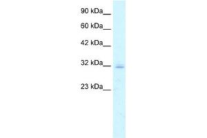 WB Suggested Anti-CLDN15 Antibody Titration:  5. (Claudin 15 anticorps  (C-Term))