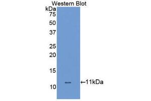 Western Blotting (WB) image for anti-Solute Carrier Family 6 (Neurotransmitter Transporter, Dopamine), Member 3 (SLC6A3) (AA 562-619) antibody (ABIN1867519)