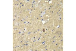 Immunohistochemistry of paraffin-embedded mouse heart using AKR7A2 antibody (ABIN5970569) at dilution of 1/100 (40x lens). (AKR7A2 anticorps)