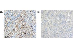 Immunohistochemical staining of CTRP6 using anti-CTRP6 (human), mAb (256-E)  in human tissue.
