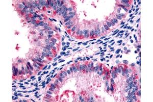 Anti-5HT2C Receptor antibody IHC of human uterus, glandular cells.