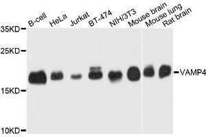 Western blot analysis of extract of various cells, using VAMP4 antibody. (VAMP4 anticorps)