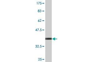 Western Blot detection against Immunogen (35.