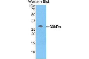 Western Blotting (WB) image for anti-Interleukin-1 Receptor-Associated Kinase 2 (IRAK2) (AA 209-458) antibody (ABIN1859467)