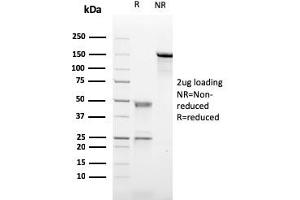 SDS-PAGE Analysis Purified CD21-Monospecific Mouse Monoclonal Antibody (CR2/2754).